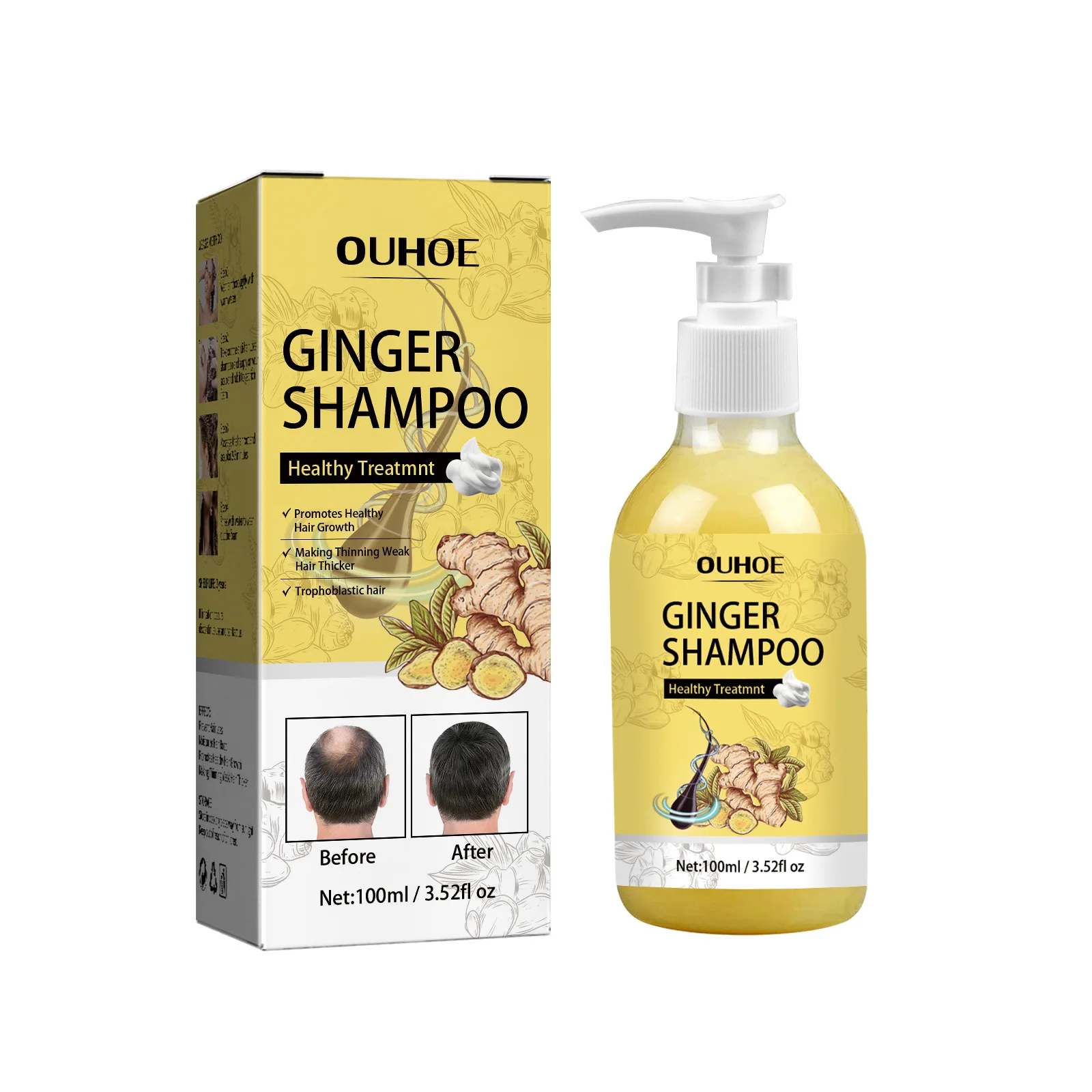 Champú para el crecimiento del cabello anticaída, tratamiento para el cuero cabelludo, Limpieza Profunda, blanqueamiento, Control de Aceite hidratante, champú Herbal de jengibre