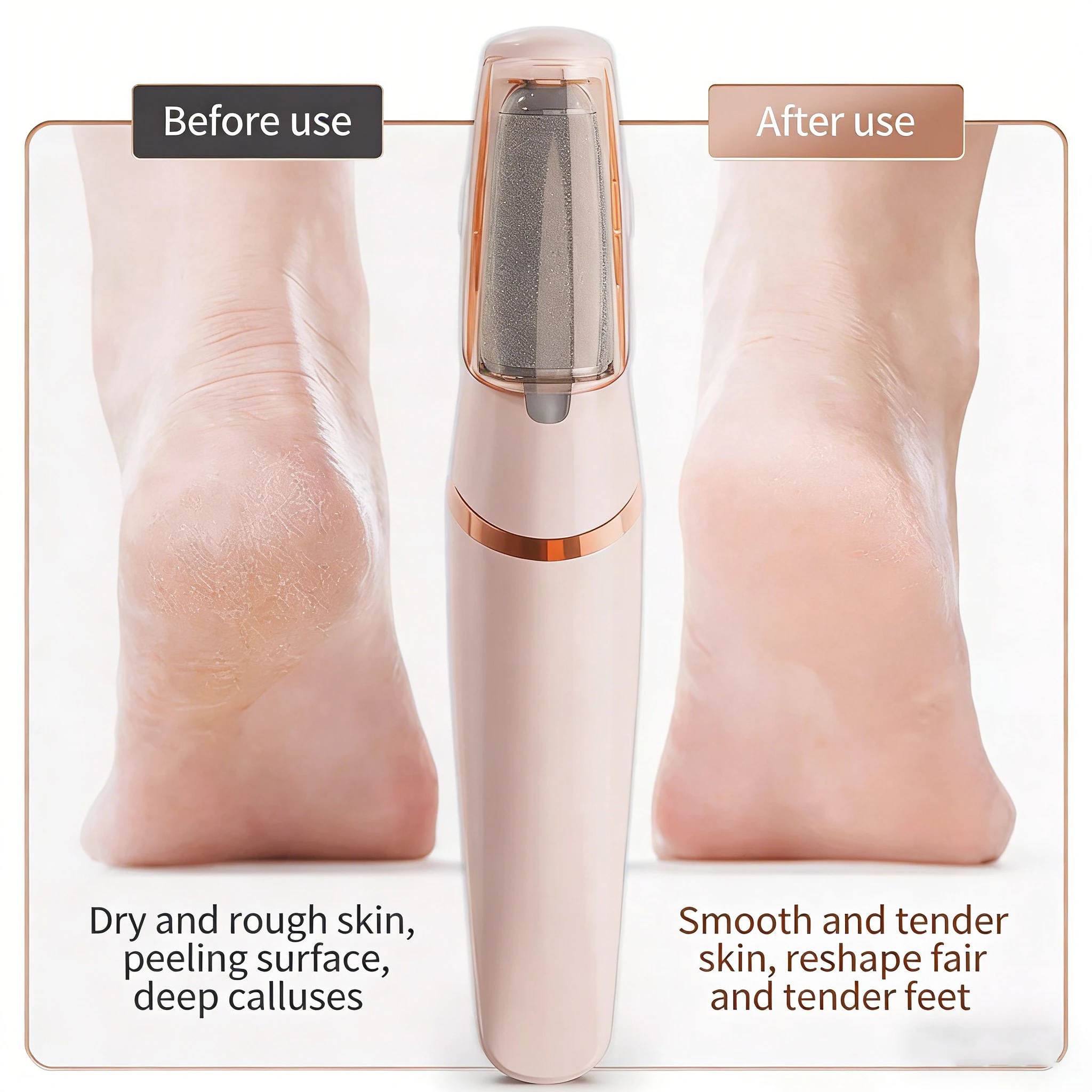 

Electric Callus Remover for Feet, Foot File Pedicure Tool, Portable Foot Callus Remover Waterproof Profess,Pedicure