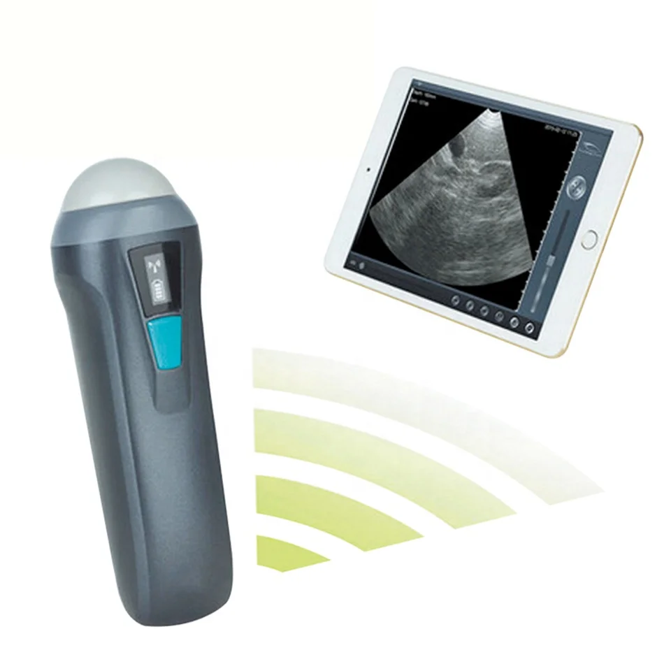 

Handheld Wireless Ultrasound Scanner Prob High Frequency Veterinary Wireless Ultradound Probe for Vet