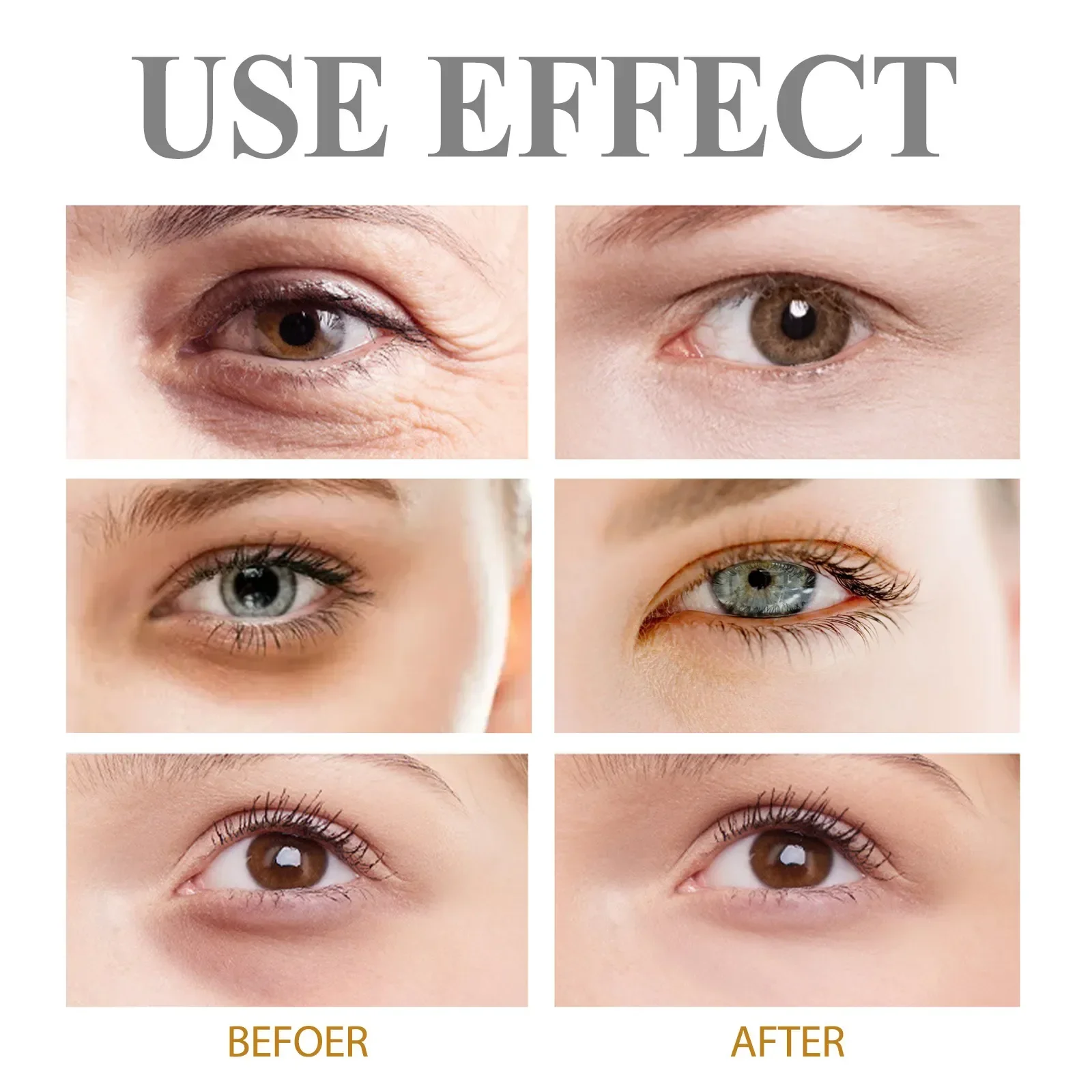 Crème pour les yeux anti-déformable au rétinol, anti-âge, élimine les cernes, les poches sous les yeux, lifting, raffermissant, blanchissant, hydratant, éclaircissant, soins pour la peau