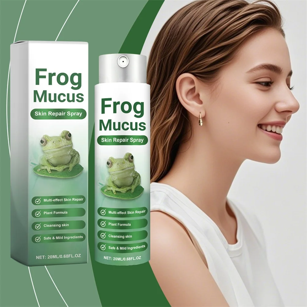 

Frogs Mucus Skin Repair Spray Gentle Formulas Remove Spots For Men Women