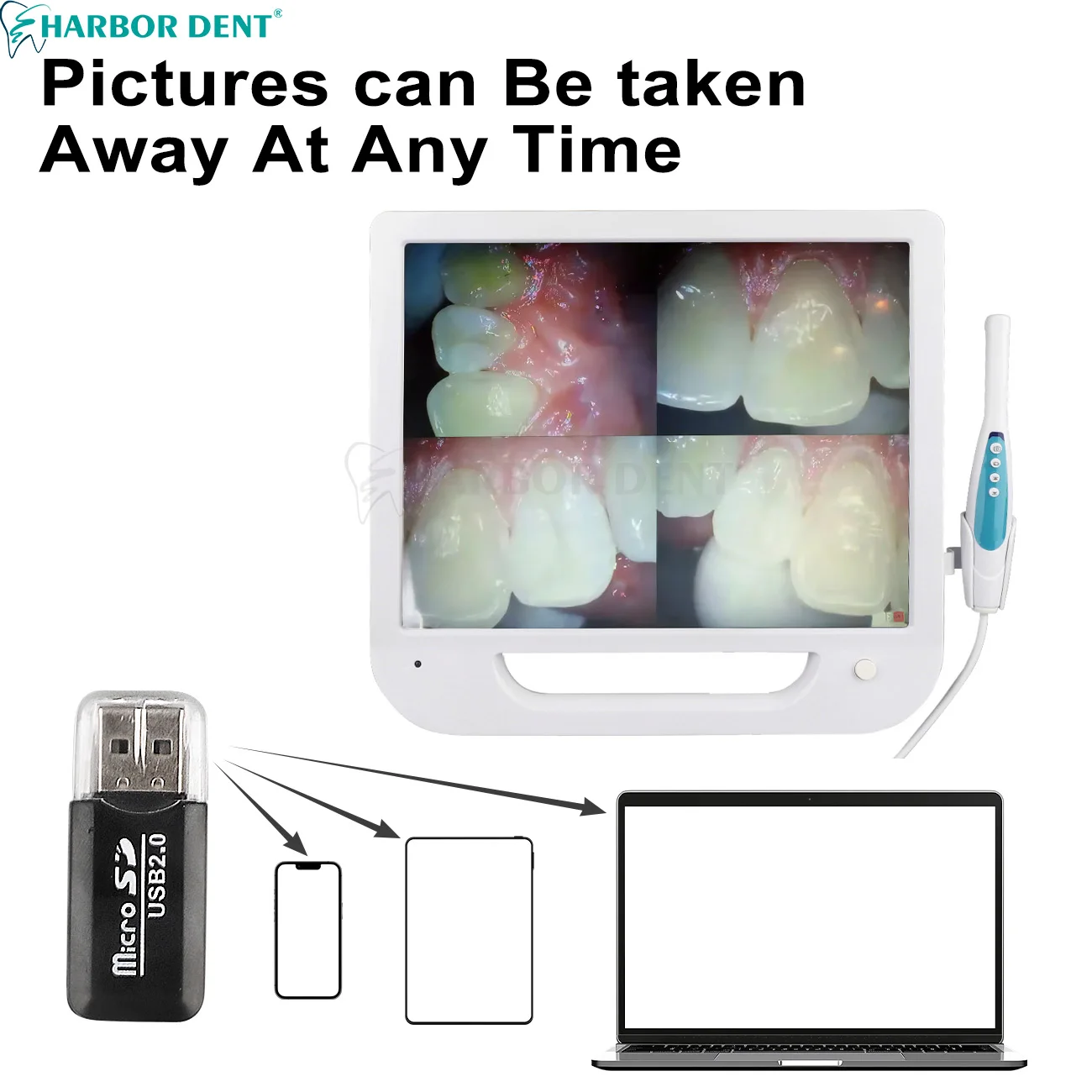 หน้าจอ LCD 17 นิ้วทันตกรรม Intraoral กล้อง 18 ล้านพิกเซล 6LED Wifi วิทยุดิจิตอลทันตกรรม Endoscope Monitor