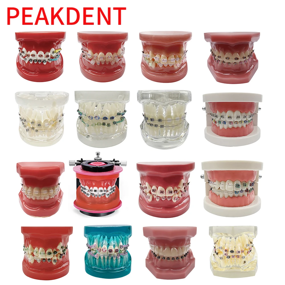 Multiple Types Dental Teeth Teaching Model Standard Orthodontic Implants Models for Dentist Demo Studying Patient Education