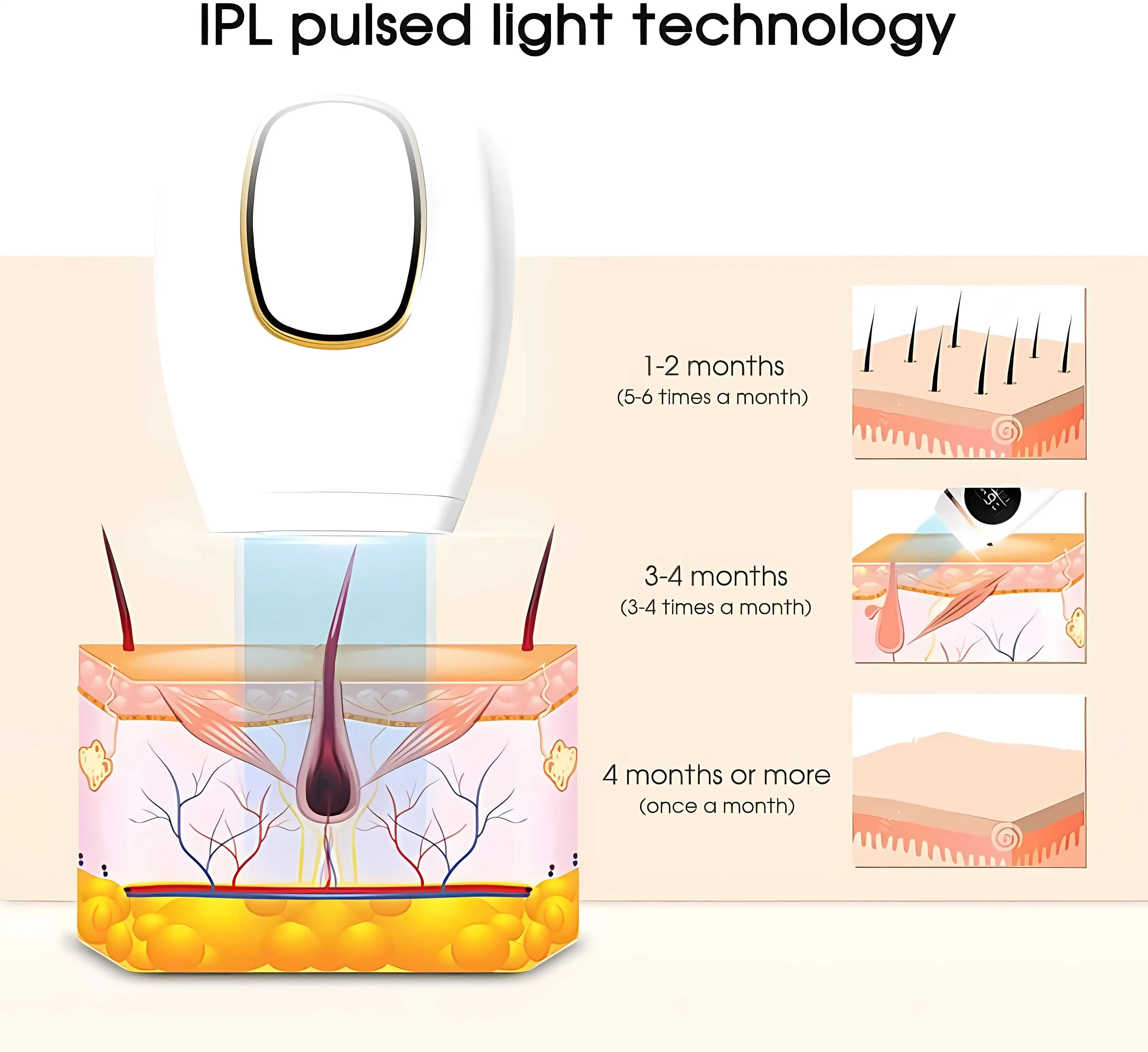 

490000 вспышек, устройство для удаления волос IPL, безболезненный лазерный эпилятор для женского постоянного удаления волос, бикини для тела, лица