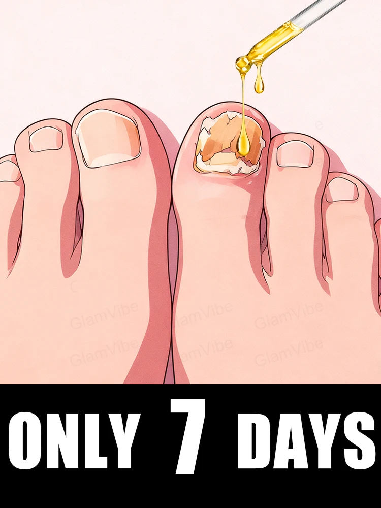 

Qᴜɪᴄᴋʟʏ ᴇʟɪᴍɪɴᴀᴛᴇ ғᴜɴɢᴜs ᴀɴᴅ ʀᴇsᴛᴏʀᴇ ʜᴇᴀʟᴛʜʏ ɴᴀɪʟs