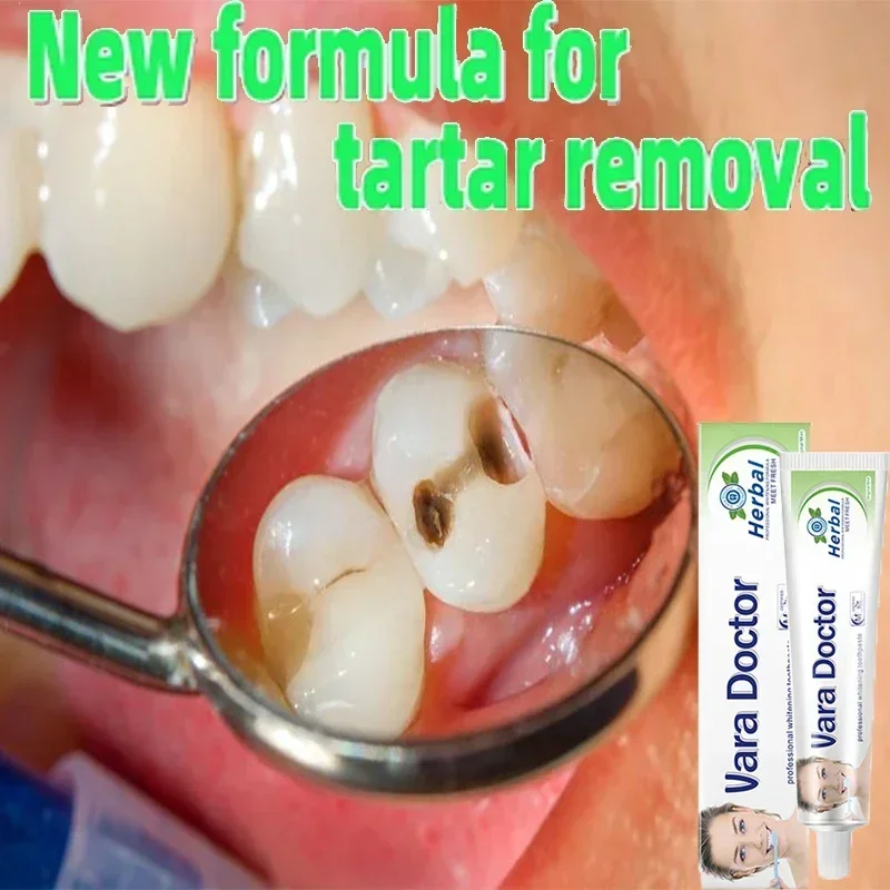 

Remover Dental Calculus Whitening Teeth Mouth Odor Removal Bad Breath Preventing Periodontitis 2024 New 0903