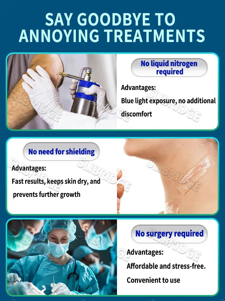 Bolígrafo de luz azul para resolver cicatrices, envío gratis, herramientas para el cuidado de los cicatrices, indoloro, uso doméstico, fácil de usar