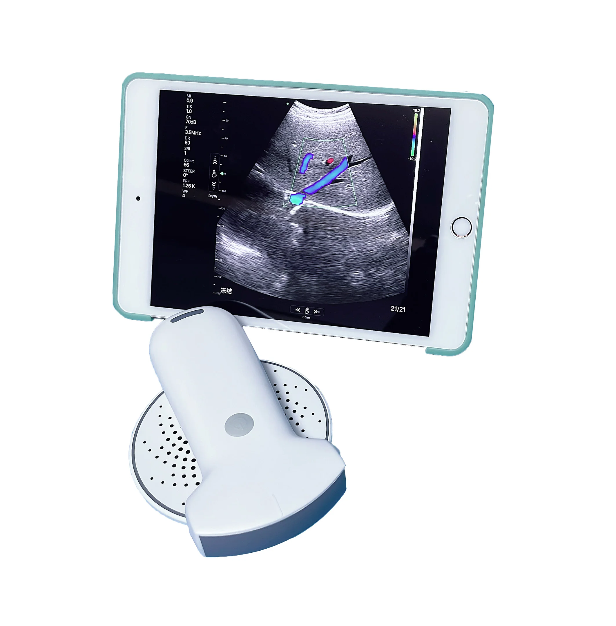 MSLPU94 192 elements Wireless Portable(Handheld) Color Doppler Ultrasound Probe Convex probe