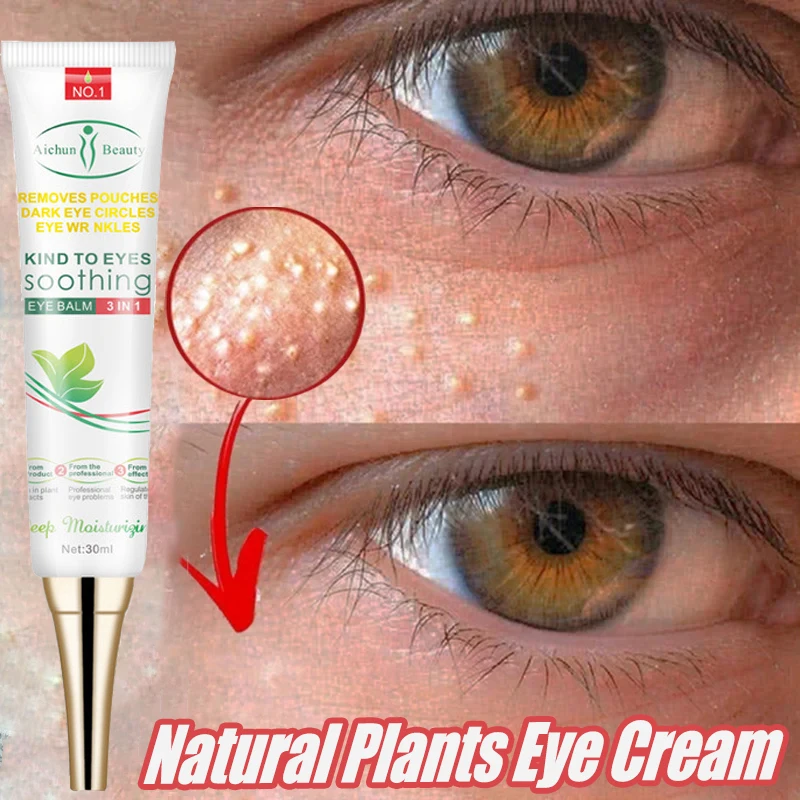 

Fat Granules Remover Eyes Cream Fade Fine Lines Anti-Puffiness Wrinkles Lift Firming Remove Dark Circles Eye Bags Eye Skin Care