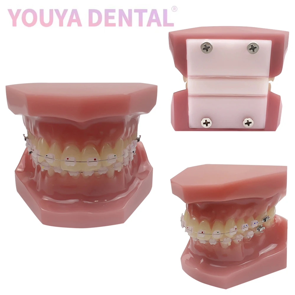 Orthodontic Teeth Practice Model All Ceramic Orthodontic Model for Dental Technician Teaching Training Studying Communication