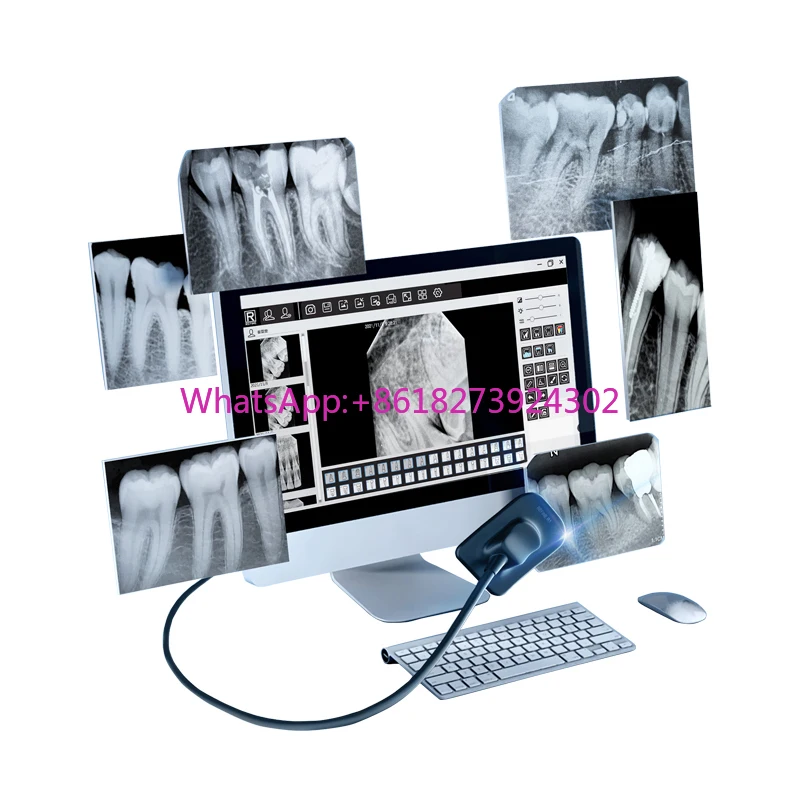 

Dental Intraoral X-ray Sensor R1/ R2 Intraoral Digital Imaging System USB RVG Imaging Sensor for Dentist Clinic