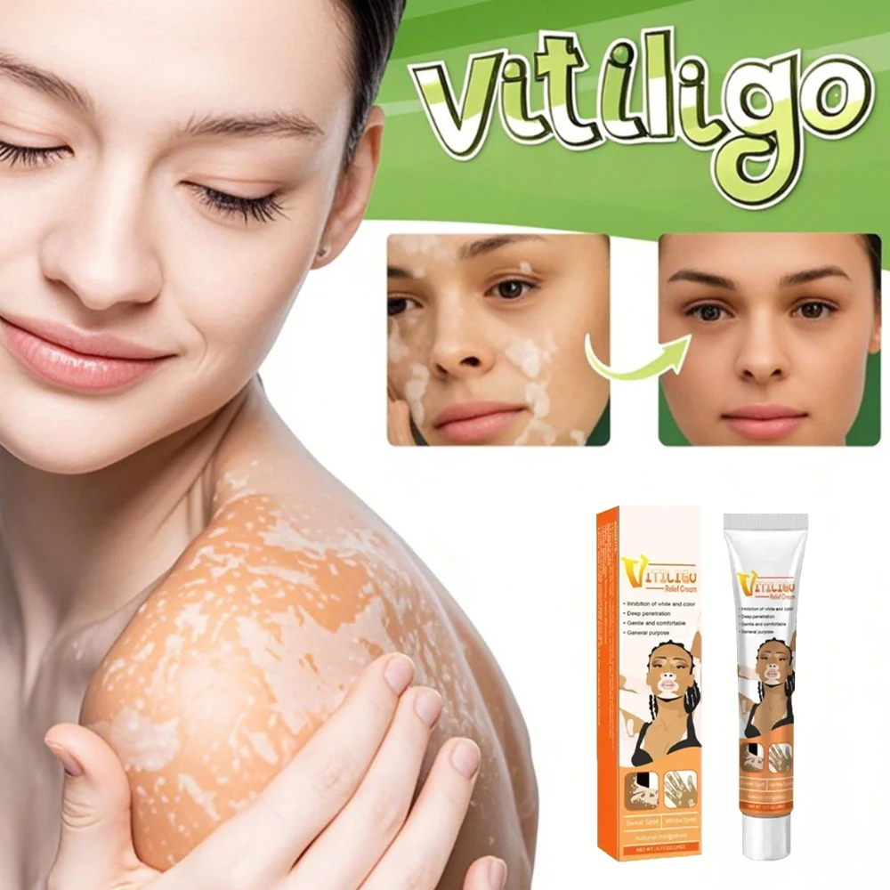 

Professional Vitiligo Care Cream for Skin White Spots Reduction Fast-Acting Spot Minimizing