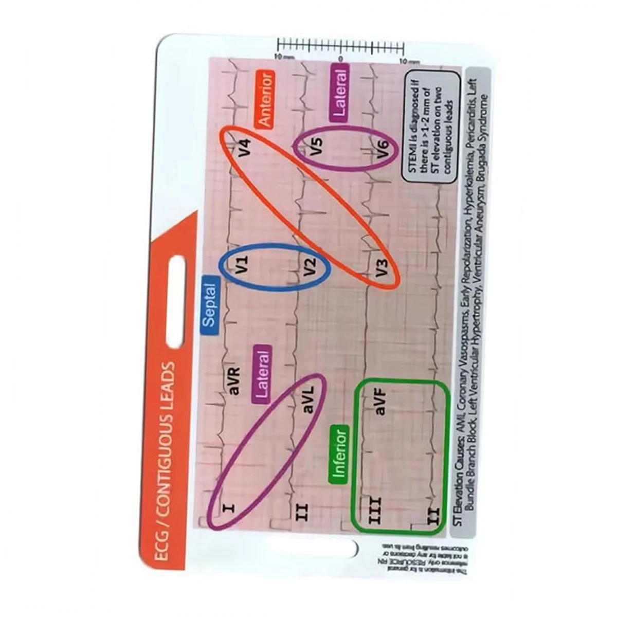 【Flash&Deal!】{STEMI 12 Lead Tool Horizontal Reference Badge ID Card,EGG Contiguous Leads Precision Measurement Household Tool