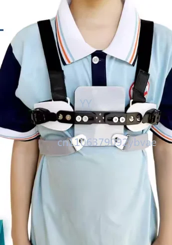 Children, adults, chicken breast braces, sternal aligners, chicken breast aligners