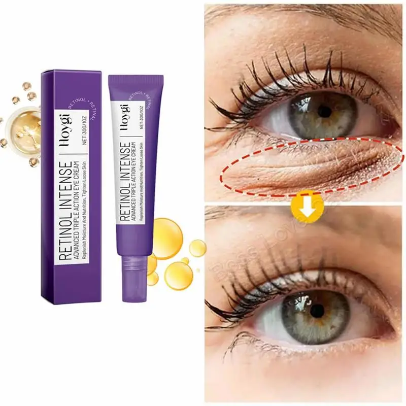 

HOYGI крем для глаз с тройным эффектом ретинола, нежный увлажняющий уход, мягкая кожа, уменьшающий тонкие линии вокруг глаз, крем для глаз, 30 г