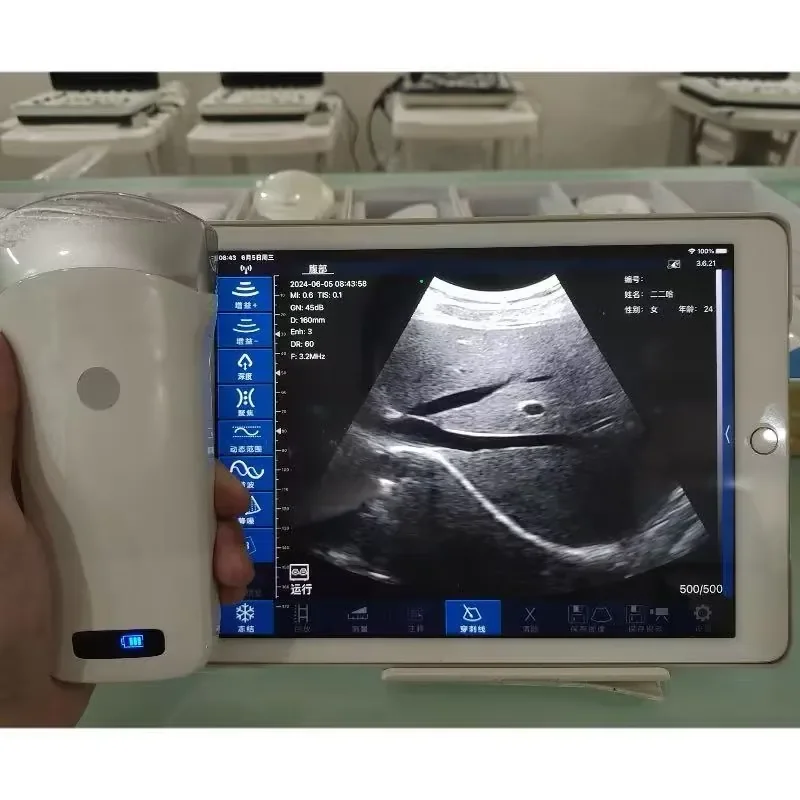 Portable Wireless Scanner Convex Array Probe for Abdominal and Internal Organ Examination