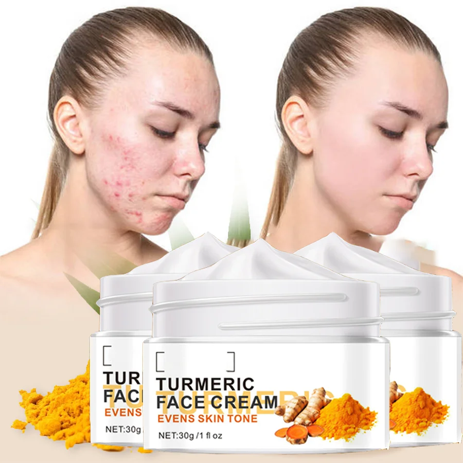 

3 Box Turmeric Glutathione Face Cream Glutathione Whitening Face Cream Reduce Dark Spots Face Whitening Cream