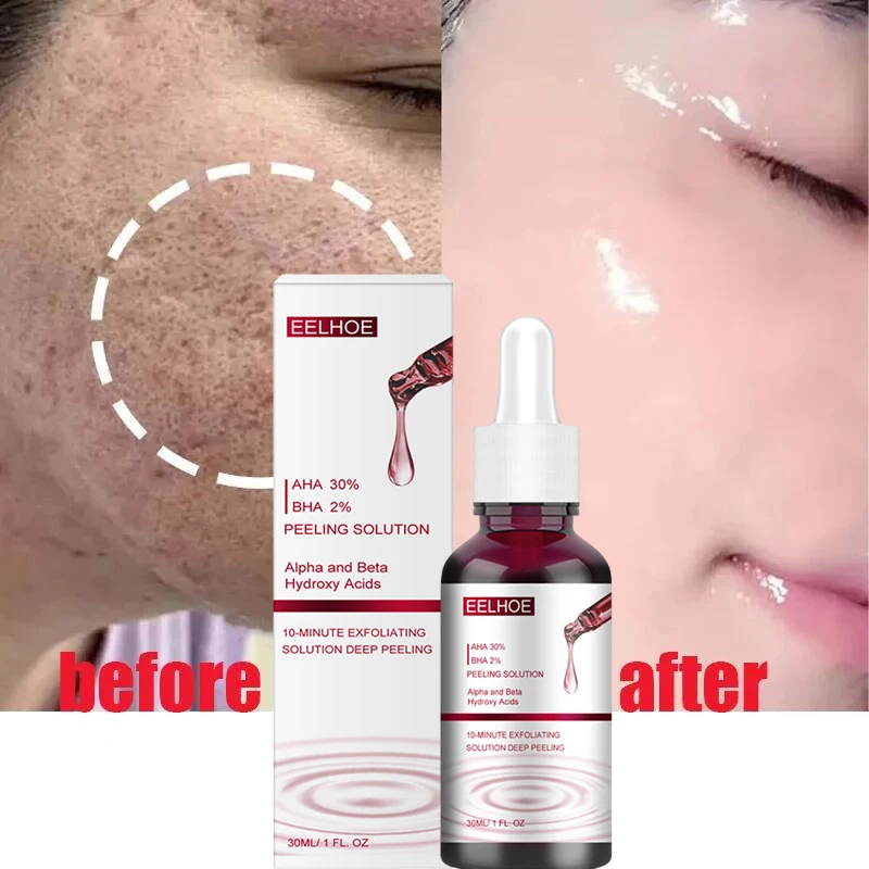 

Salicylic Acid Pore Shrinking Serum Quick Elimination Large Pores Remove Blackehead Tighten Face Smooth Skin Korean Care Product