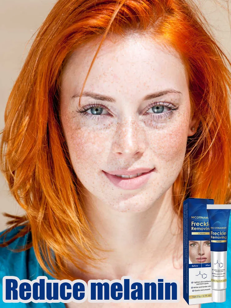 

Dark Spot Correcting Serum Remove Freckle Whitening Moisture Powerful Removal Sun Spots Melasma Age-related Dark Spots Brighten