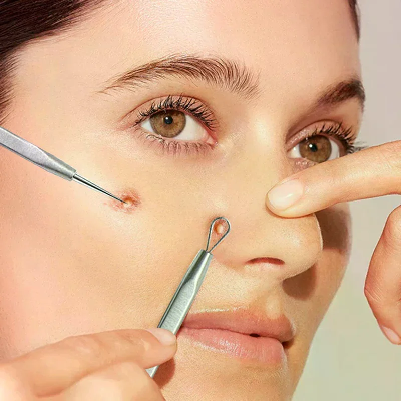 أداة إزالة الرؤوس السوداء ذات الرأس المزدوج من الفولاذ المقاوم للصدأ أدوات إزالة حب الشباب والزهم للعناية ببشرة الوجه