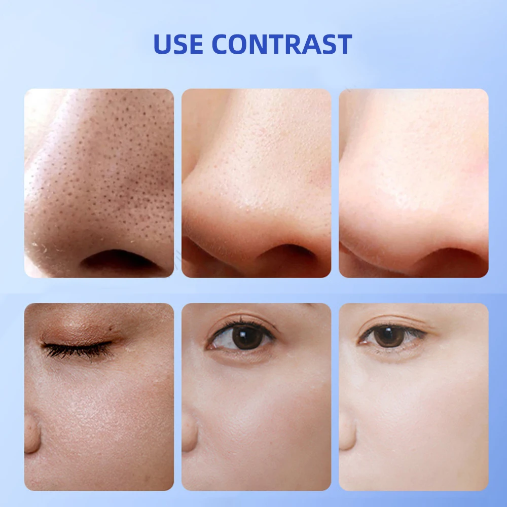 deep-cleaning-pores-ultrasonic-atomization-blue-light-beauty-device