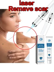 Laser Repair of Skin Scars Hot Sale