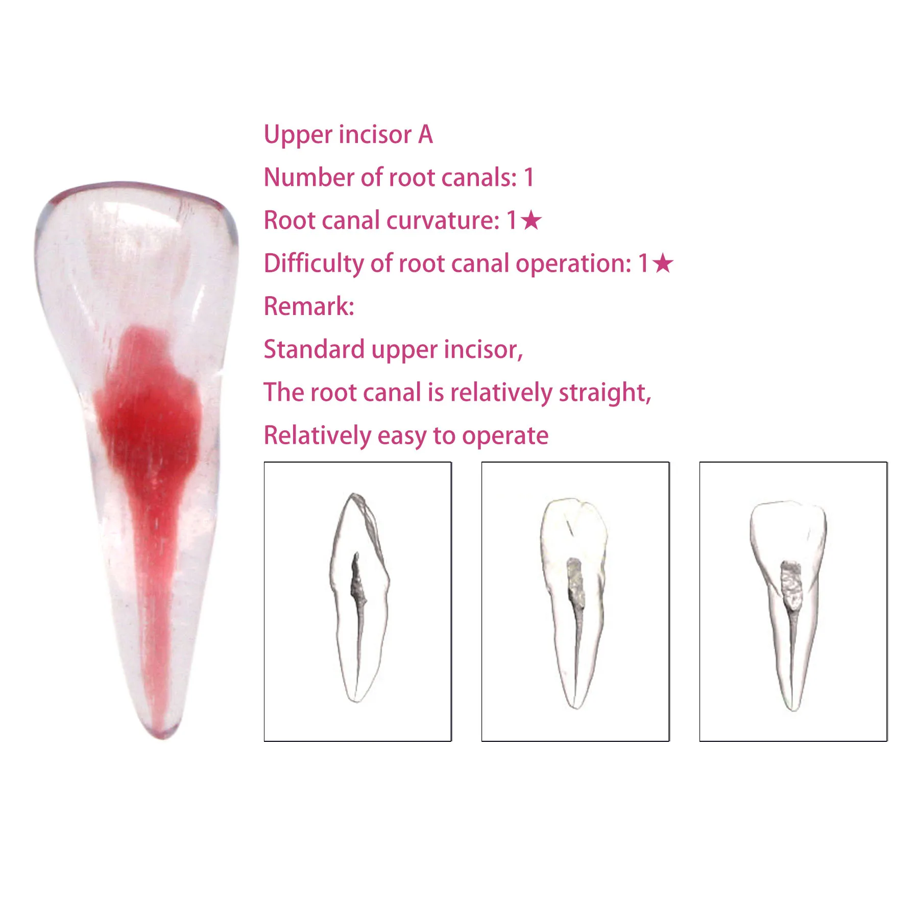 

RCT 3D Print Dental Blocks Files Practice Block Endo Training Model Replicas Upper Incisor A 1PC