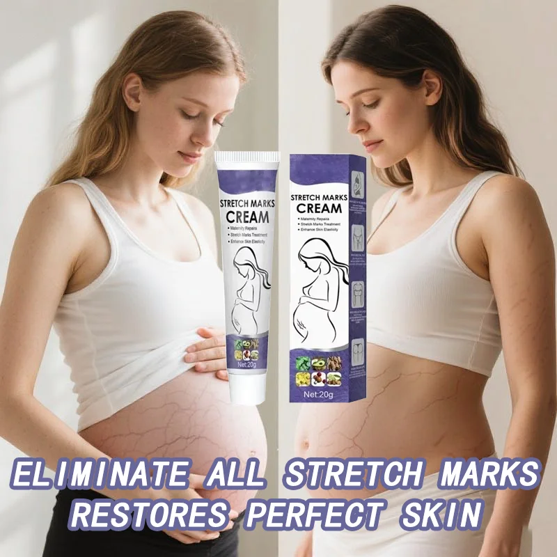 

Исчезающий крем от растяжек. Укрепляющий крем для подтяжки кожи. Улучшает эластичность. Эффективное удаление следов после беременности. Питает для беременных.