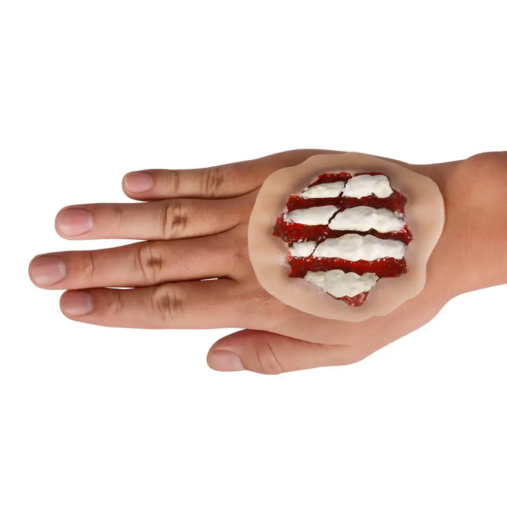 Ultrassist Hand Fracture Wound Self-Adhesive Silicone Model Trauma Trainer Wound Simulation for EMT First Aid Nursing Medic Care
