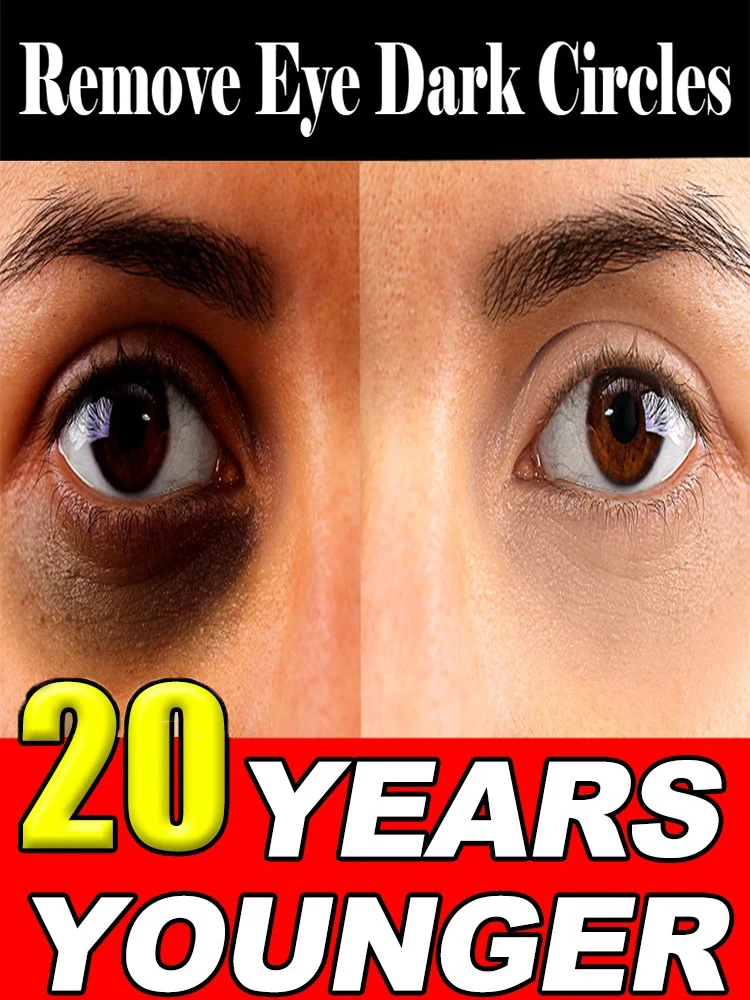 

Brighten Eye Solve Eye Problems