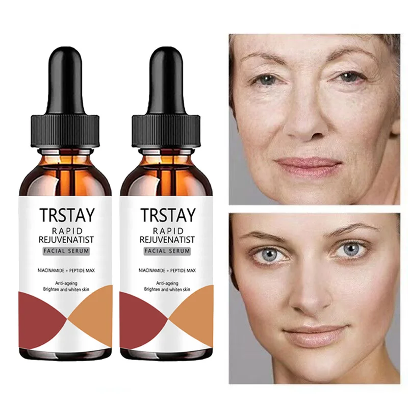 

/TRSTAY Nicotinamide Essence Can Remove Black Spots, Whiten And Brighten Pores, Shrink Hyaluronic Acid Collagen, And Protect The