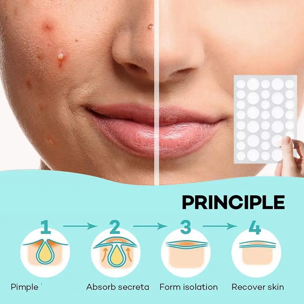 72/288pcs Face Acne Patch Invisible Skin Care Pimple Acne Patches Anti-inflammatory Healing Absorbing Spot Sticker Covering Acne