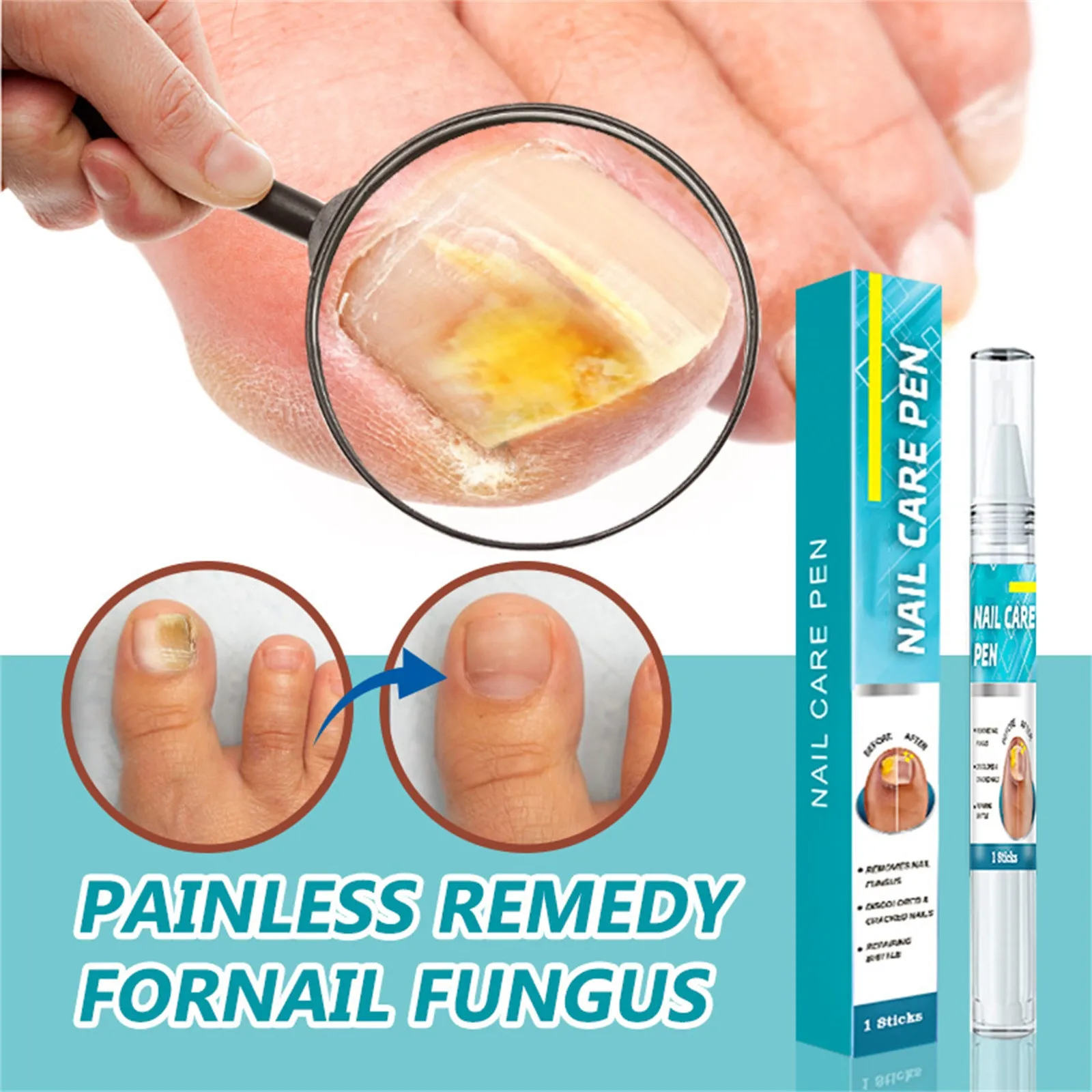 Toenail Fungus Care, FastActing Nail Care Liquid For Fungus Under & Around Restores The Healthy Appearance Of Nails 5ml