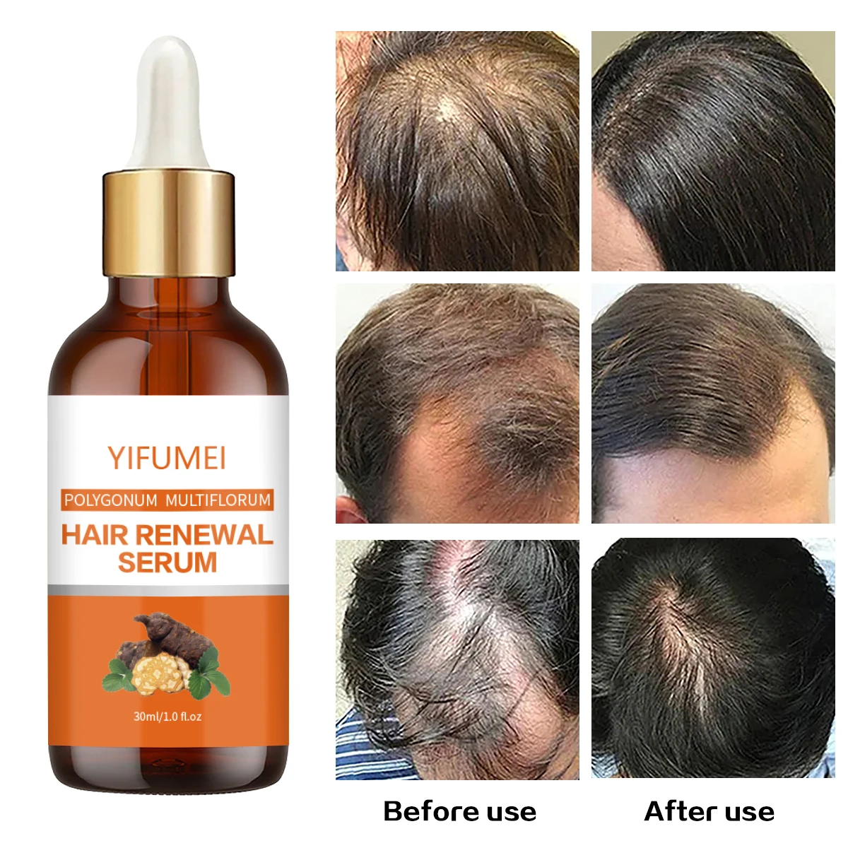 

Hair Renewal Serum Nourishing Treatment for Split Ends Rosemary Oil for Hair Growth Dry Organics Hair Care Oil Beauty Health