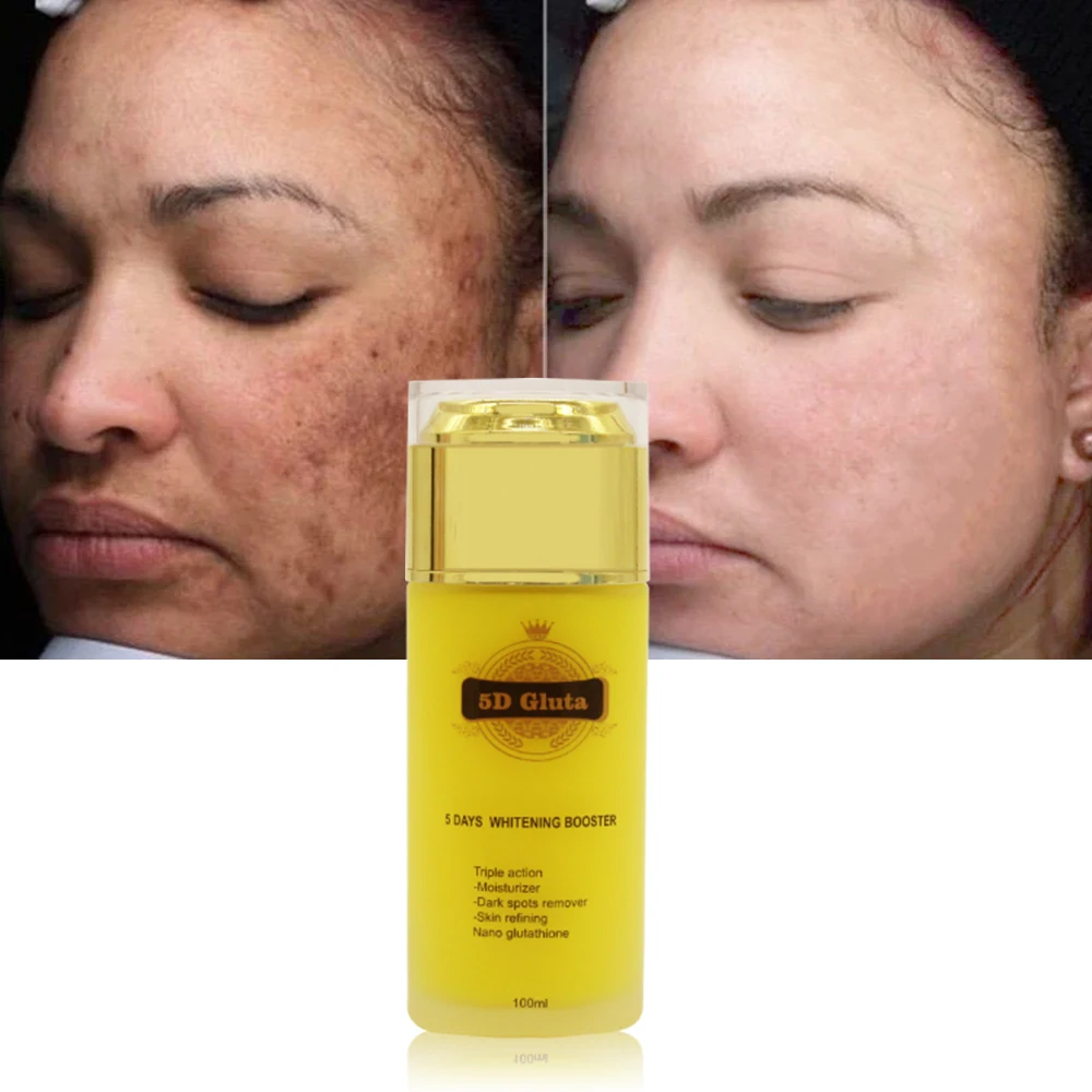 5 Days Whitening Serum Dark Spot Remover and Brightening Skin Tone Face Serum With Glutathione & Vitamin C