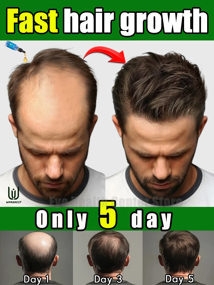 

H air Repair Essence, develop thick hair in 7 days and avoid baldness