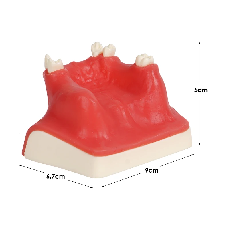 Implant dentystyczny Model nauczania Model zatoki szczękowej górnej szczęki Model zębów do studiowania praktyki studenckiej dentysty