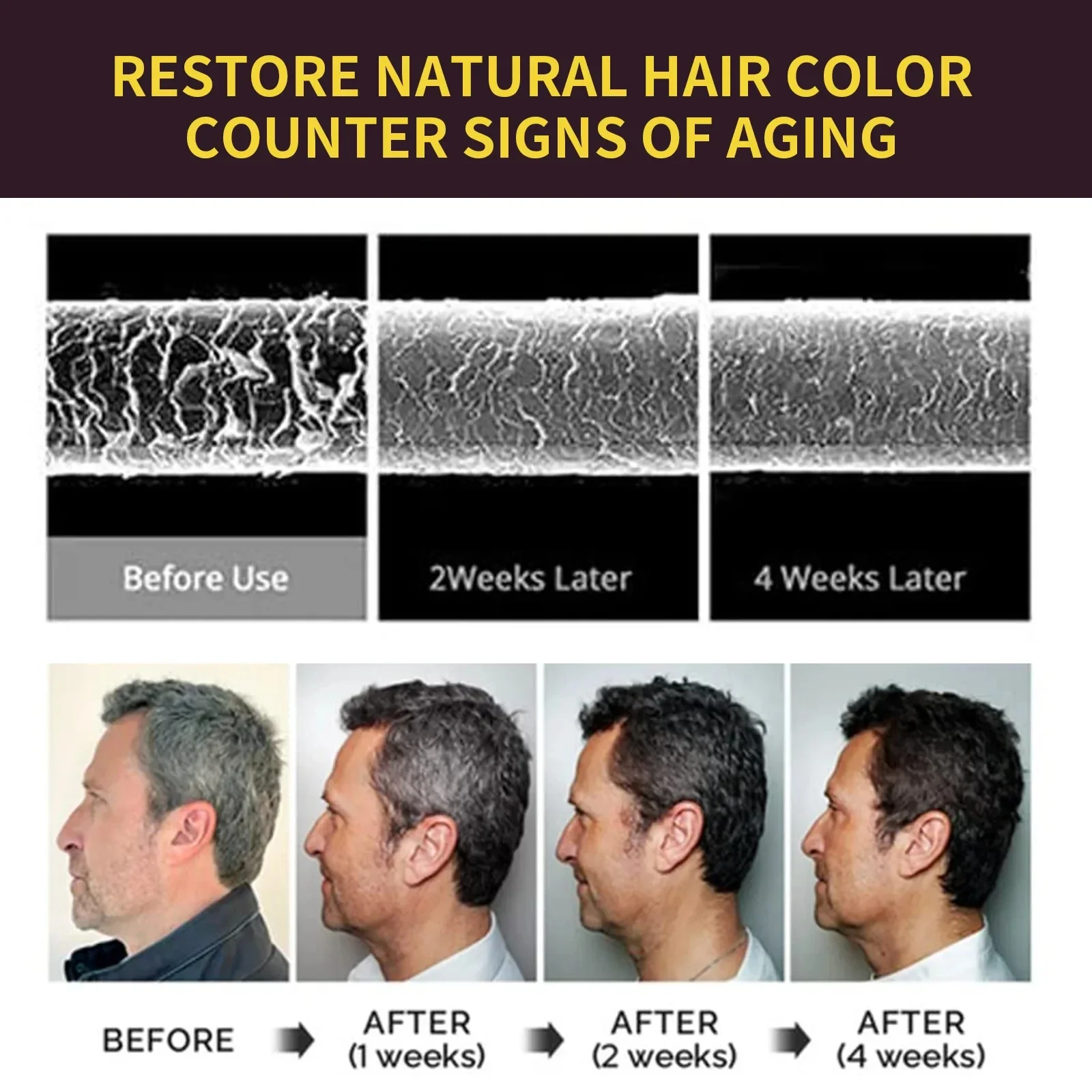 Black Hair Dye Shampoo White Hair Dye To Black Shampoo Activate Hair Follicle Melanin White Treatment 3 In 1 For Men Women