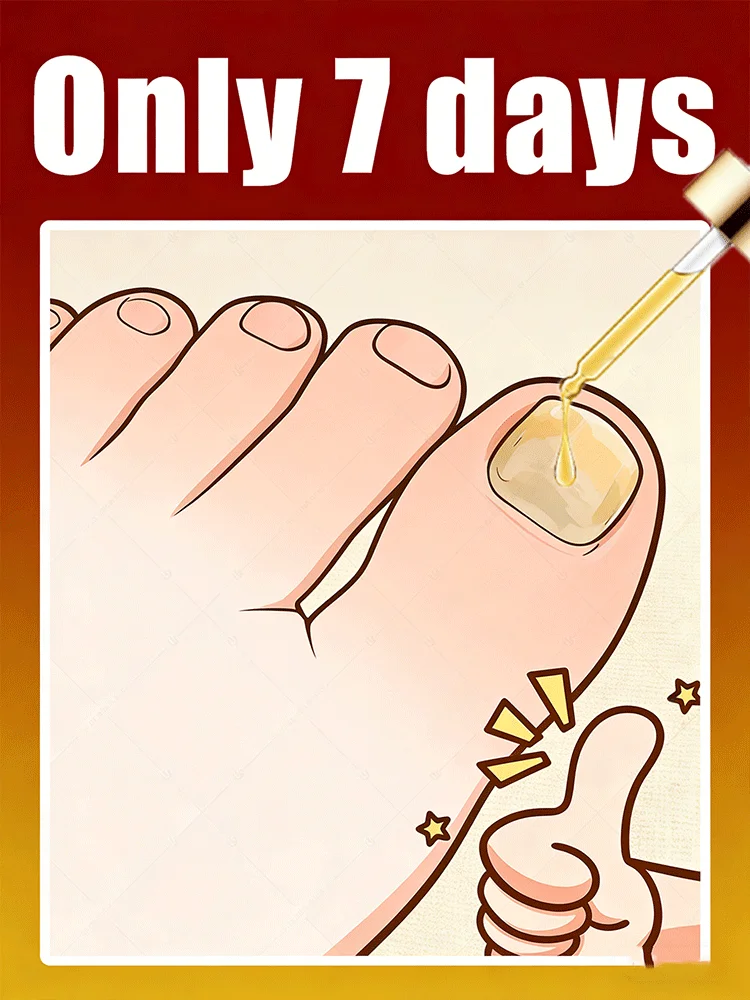 

Лазерная ручка Необходимое устройство для лазерной терапии с синим светом для всей семьи, ногти становится полупрозрачным и без грибка.