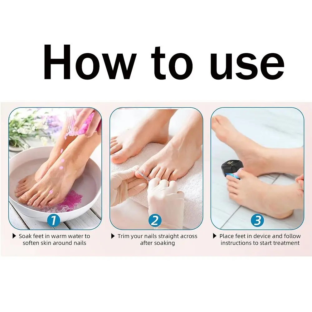 Traitement Laser efficace des champignons des ongles, lumière LED, Rechargeable, dispositif pratique, lampe Portable pour enlever les champignons des ongles