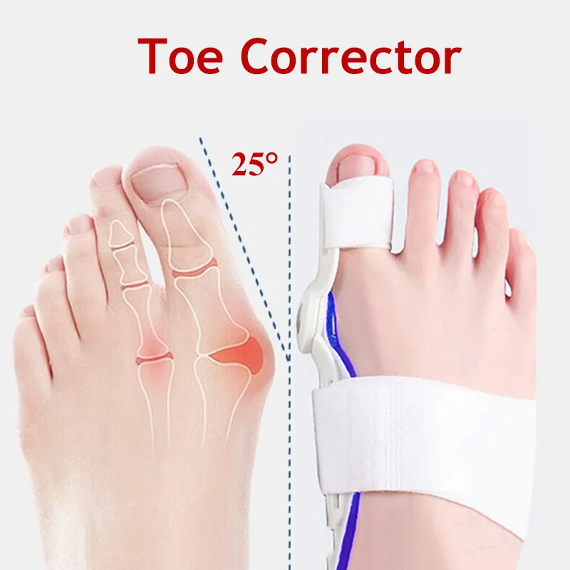 1pc Hallux Valgus Big Bone Toe Bunion Splint Haarglätter Bunion Corrector Fuß Schmerzen Relief Fußpflege Schutz Fußpflege werkzeuge