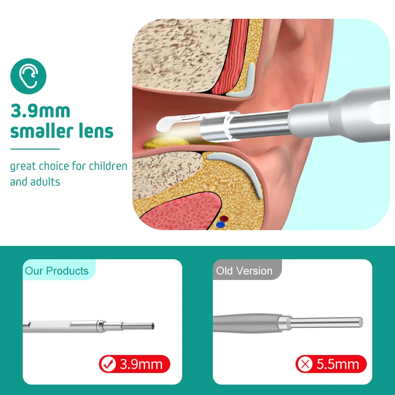 Digital Otoscope with Gyroscope 3.9MM 4.5 \