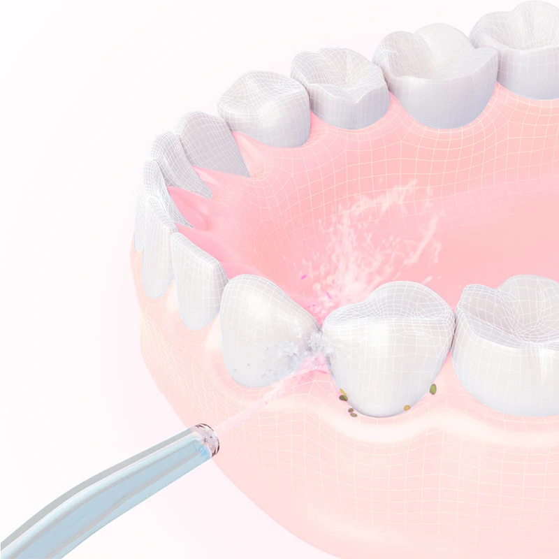 Bicos de fio dental de água de substituição para irrigador oral xiaomi mijia todos os modelos, padrão de palheiro de água/pontas de recarga ortodôntica 2 peças