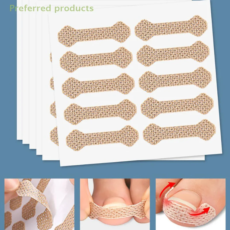 60pcs Ingrown Toenail Corrector Strips Anti-Nail Patch Long Toe Pad for Paronychia Foot Care Sleeping Nail Patch Nails in Flesh