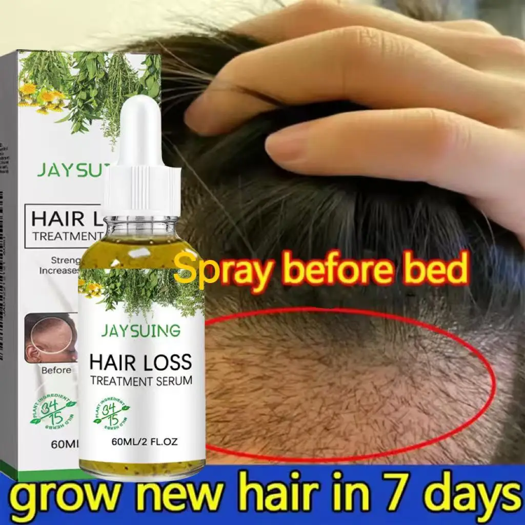 

7 Days Ginger Hair Growth Serum Fast Promote Hair Regrowth Products Anti Hairs Loss Repair Scalp Baldness Nourish Hair Root Care