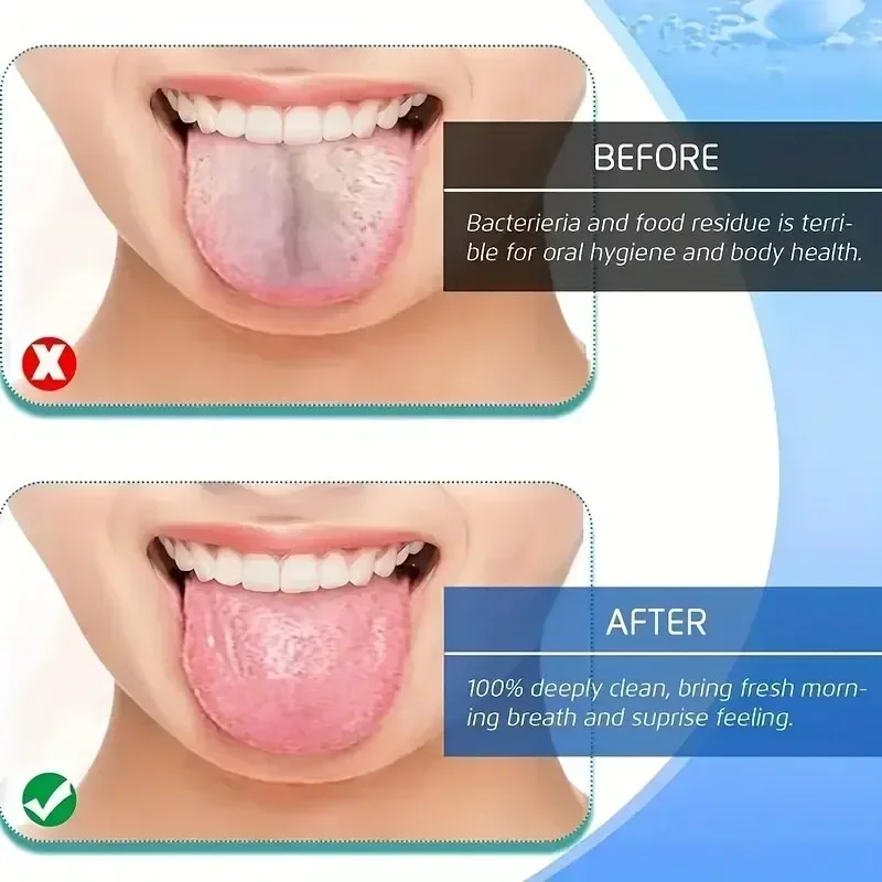 Thumbnail 4 - #63 Best Tongue Scrapers to Buy In 2026