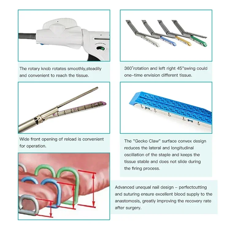 Hot Price Disposable Endoscope Linear Cutting Stapler And Cutting Assembly Simple Use laparoscopic Linear Cutter Stapler