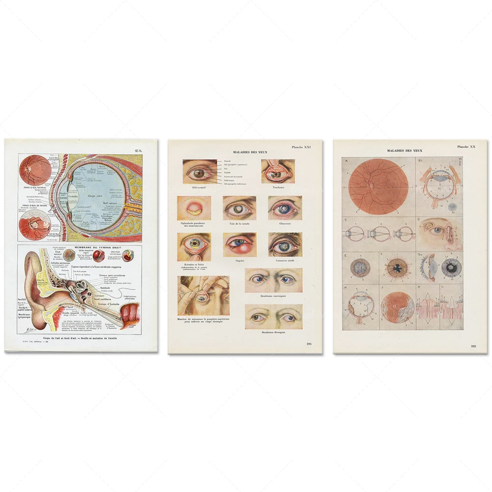 1962 Small eye, ear medical anatomy, antique vintage medical illustration for ophthalmologist, medical office decoration