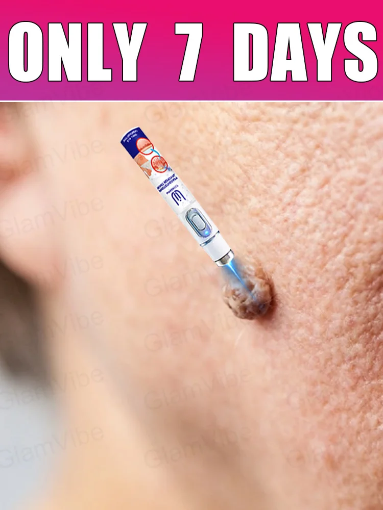 

2nd ᵍᵉⁿᵉʳᵃᵗⁱᵒⁿ ᵘᵖᵍʳᵃᵈᵉᵈ wᵃʳᵗ ⸴ ʳᵉpᵃⁱʳ wᵃʳᵗˢ ʳᵒoᵗ ⸴ ᑫᵘⁱᶜᵏˡʸ