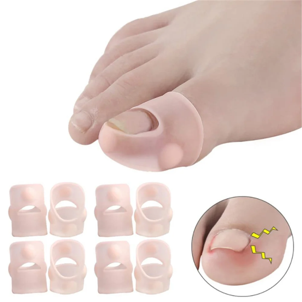 1 Pair Silicone Ingrown Toenail Correction Invisible Toe Nail Treatment Elastic Straightening Clip Brace Foot Care Pedicure Tool